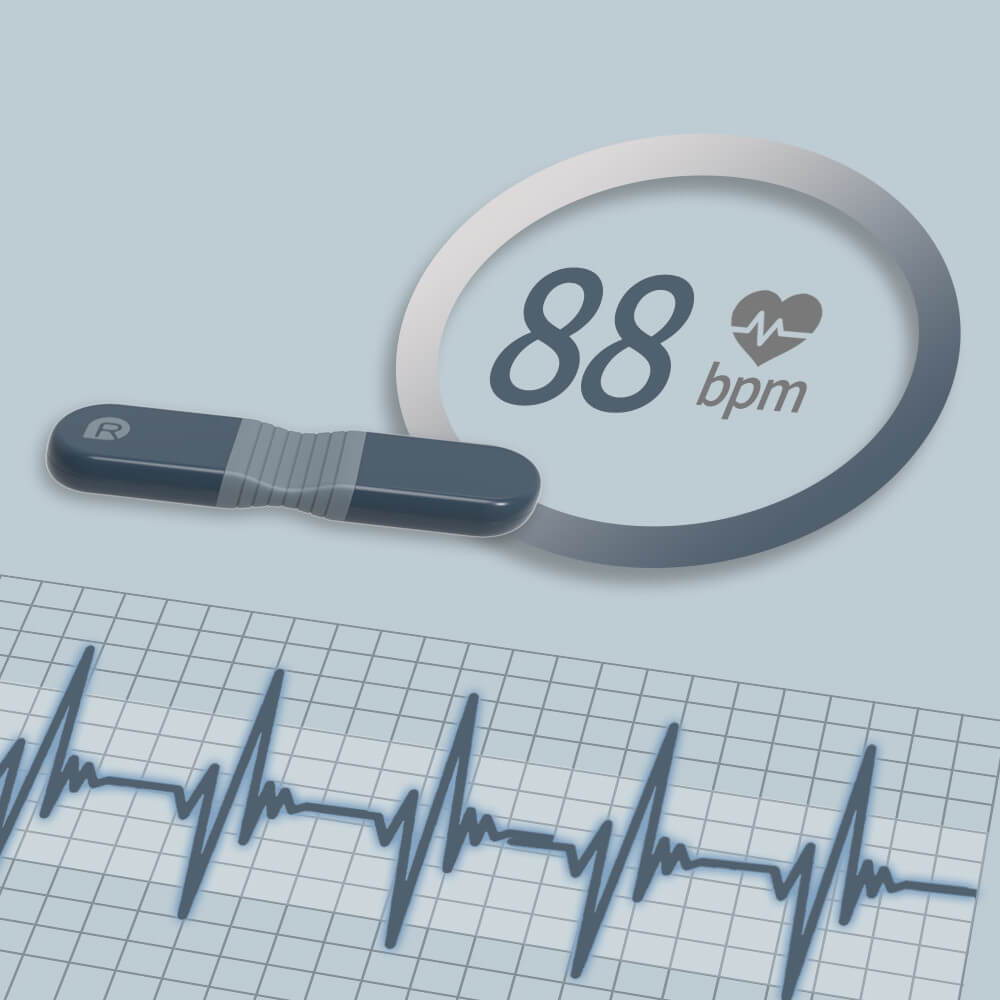 Wearable ECG/EKG Monitor with AI Analysis 24Hour ECG/EKG Holter